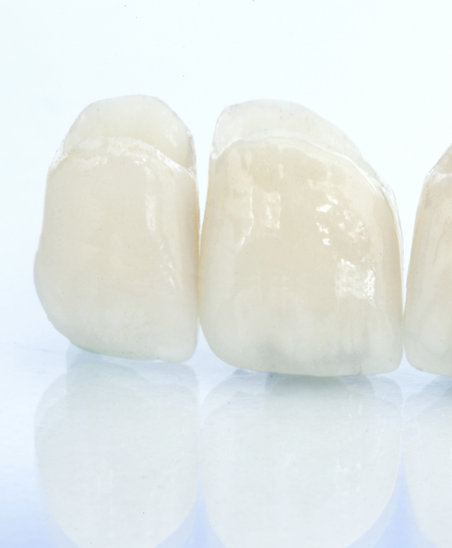 補綴治療について